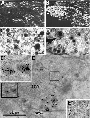 Neuropeptide and Small Transmitter Coexistence: Fundamental Studies and Relevance to Mental Illness